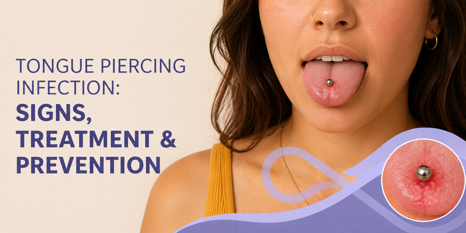 Tongue Piercing Infection: Signs, Treatment & Prevention